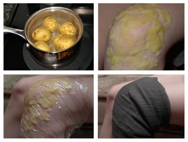 Bulvių naudojimas šiltu sąnario