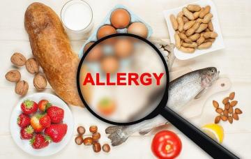 Ką svarbu žinoti apie alergiją maistui?